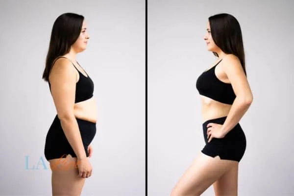 link between body image and mental health Middlewich
