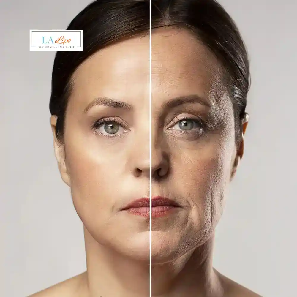 How Can You Tell If Non-Surgical Skin Tightening Is Right for You Middlewich?