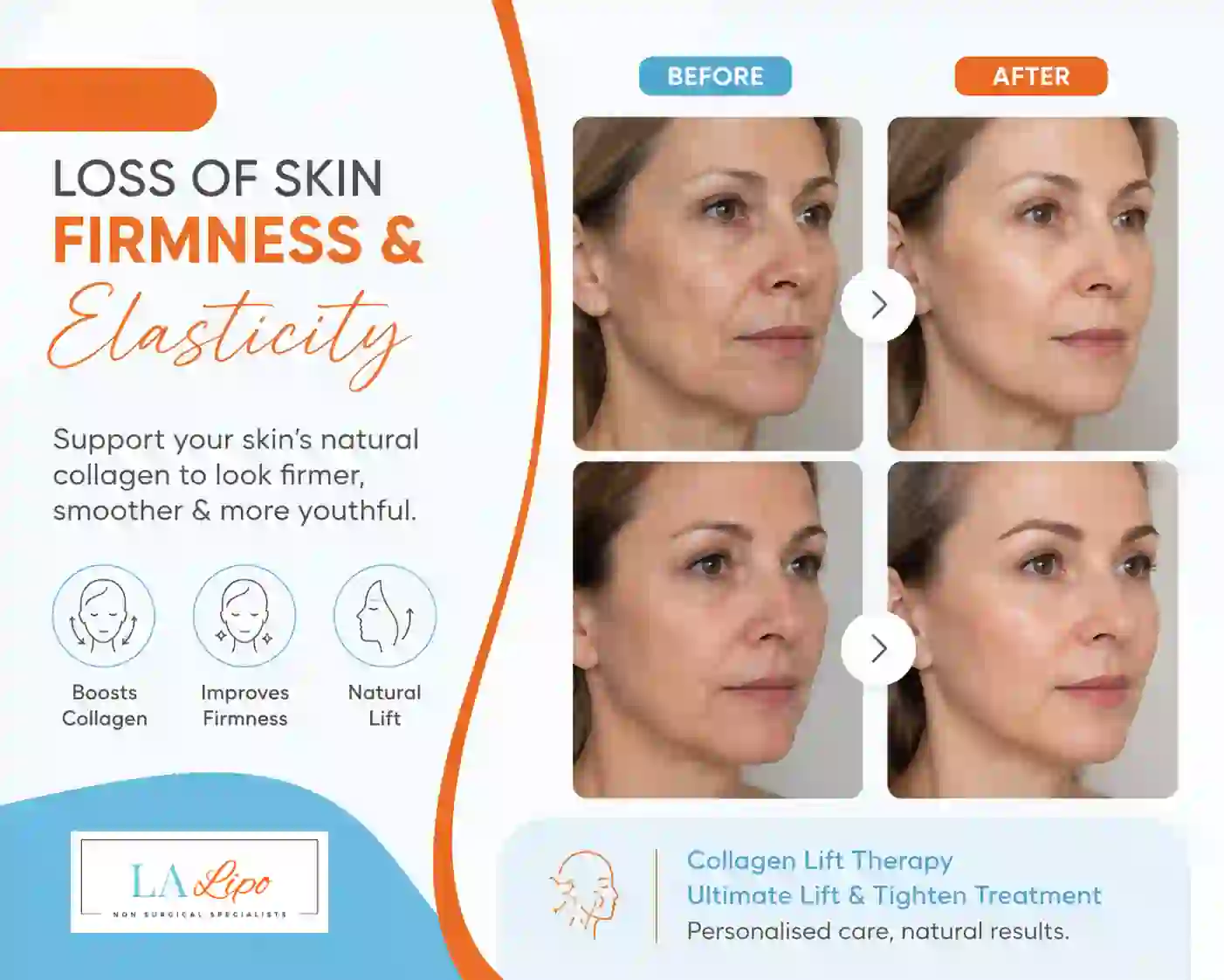 Sign #7: Loss of Skin Firmness and Elasticity Middlewich