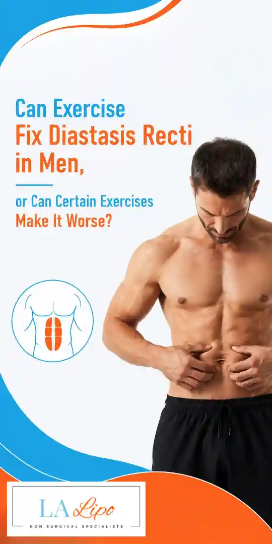 Can Exercise Fix Diastasis Recti in Men, or Can Certain Exercises Make It Worse Middlewich?